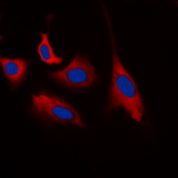 3 - Anti-CDK5 (Phospho-Y15) Antibody AP60246
