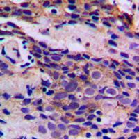 19 - Anti-CDK5 (Phospho-Y15) Antibody AP60246