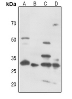 1 - Anti-CDK5 (Phospho-Y15) Antibody AP60246