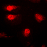 3 - Anti-p27 Kip1 (Phospho-T187) Antibody AP60247
