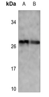 1 - Anti-p27 Kip1 (Phospho-T187) Antibody AP60247