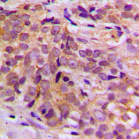 19 - Anti-CEP170 Antibody AP60248