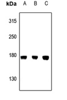 1 - Anti-CEP170 Antibody AP60248