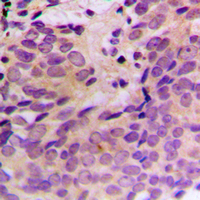 19 - Anti-CERKL Antibody AP60249