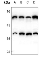 1 - Anti-CERKL Antibody AP60249