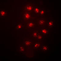 3 - Anti-CHK2 (Phospho-T383) Antibody AP60250