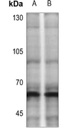 1 - Anti-CHK2 (Phospho-T383) Antibody AP60250
