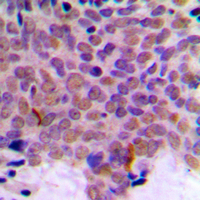 19 - Anti-CLK1 Antibody AP60252