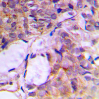 19 - Anti-CNK2 Antibody AP60254