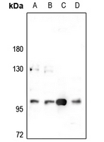 1 - Anti-CNK2 Antibody AP60254
