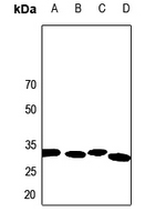1 - Anti-Calponin 2 Antibody AP60255