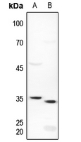 1 - Anti-ICER Antibody AP60256