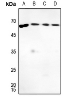 1 - Anti-G-CSF Antibody AP60257