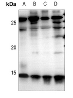 1 - Anti-Cystatin C Antibody AP60258