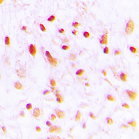 19 - Anti-CTBP1 Antibody AP60259