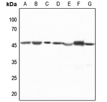 1 - Anti-CTBP1 Antibody AP60259