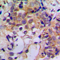 19 - Anti-Cathepsin Z Antibody AP60260