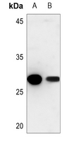 1 - Anti-Cathepsin Z Antibody AP60260
