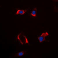3 - Anti-Cytochrome P450 2S1 Antibody AP60261