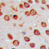 19 - Anti-Cytochrome P450 2S1 Antibody AP60261