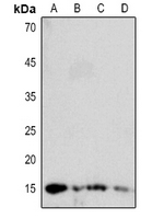 1 - Anti-DBI Antibody AP60262