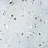 19 - Anti-DDX24 Antibody AP60263