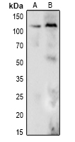 1 - Anti-DDX24 Antibody AP60263