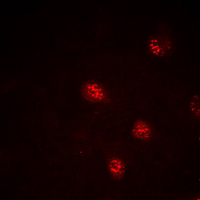 3 - Anti-DDX5 Antibody AP60264