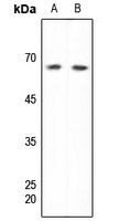 1 - Anti-DDX5 Antibody AP60264
