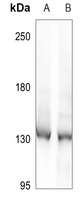 1 - Anti-DDX8 Antibody AP60266
