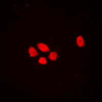 3 - Anti-DLX3 Antibody AP60267