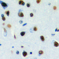 19 - Anti-DLX3 Antibody AP60267