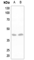 1 - Anti-DLX3 Antibody AP60267