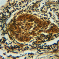 19 - Anti-CRMP2 (Phospho-S522) Antibody AP60268