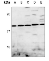 1 - Anti-DUSP22 Antibody AP60269