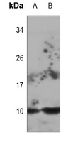 1 - Anti-DYNLL2 Antibody AP60270
