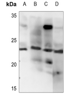 1 - Anti-Endothelin 1 Antibody AP60271