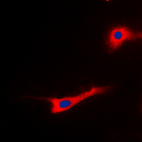 3 - Anti-EEF2 (Phospho-T56) Antibody AP60272