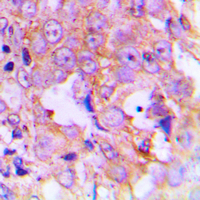 19 - Anti-EEF2 (Phospho-T56) Antibody AP60272