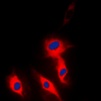 3 - Anti-Ephrin A5 Antibody AP60273