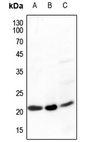 1 - Anti-Ephrin A5 Antibody AP60273