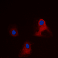 3 - Anti-EIF3L Antibody AP60275