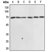1 - Anti-EIF3L Antibody AP60275