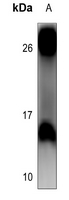 1 - Anti-4EBP1 Antibody AP60276