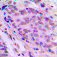 19 - Anti-MEN Antibody AP60277