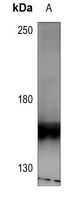 1 - Anti-HER4 (Phospho-Y1284) Antibody AP60278