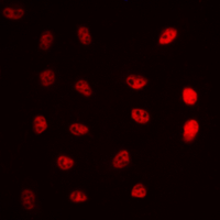 3 - Anti-ERCC5 Antibody AP60280