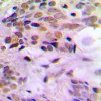 19 - Anti-ERCC5 Antibody AP60280