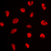 3 - Anti-Estrogen Receptor alpha (Phospho-S106) Antibody AP60281