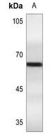 1 - Anti-Estrogen Receptor alpha (Phospho-S106) Antibody AP60281